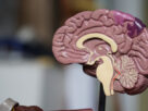 Cerebro